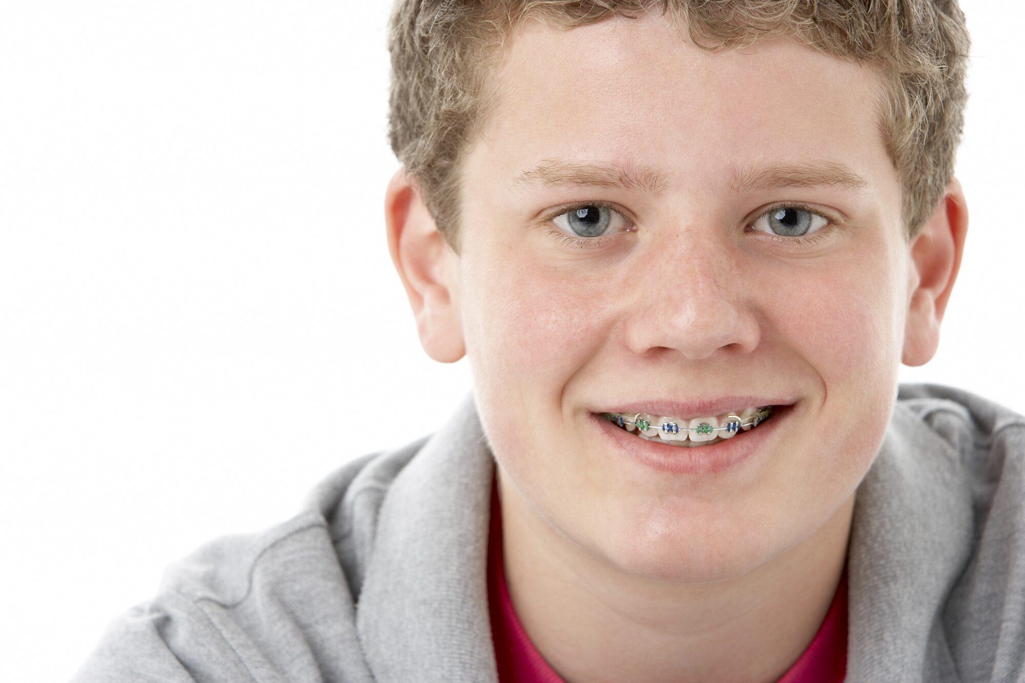 Junge mit fester Zahnspange